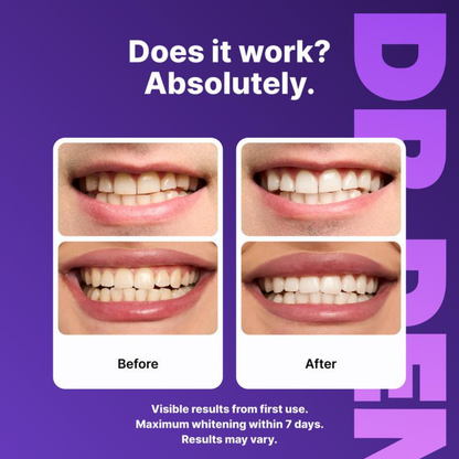 Teeth Whitening Strips
